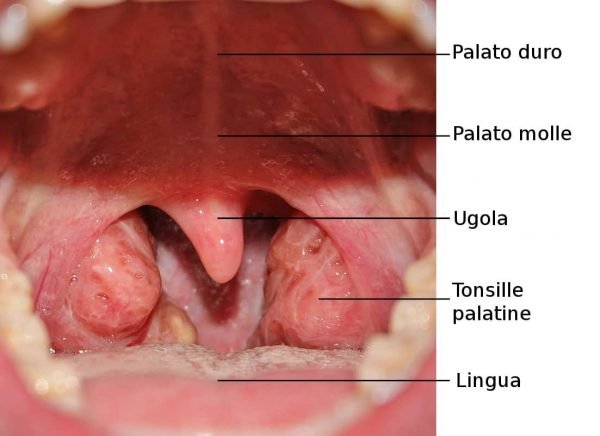 টনসিলের ঔষধ